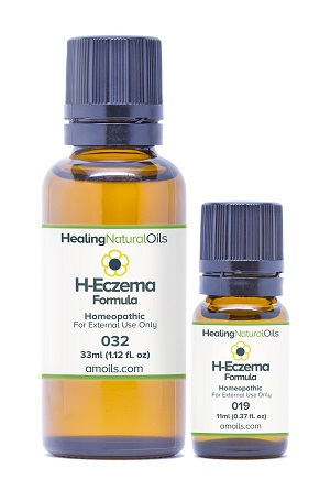 Treat Eczema Symptoms Gently - Topical Homeopathic Eczema Remedy For All Ages